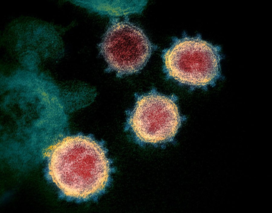 NIAID Rocky Mountain Laboratories (RML), U.S. NIH - https://www.niaid.nih.gov/news-events/novel-coronavirus-sarscov2-images